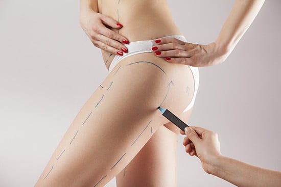 thigh lift surgery Manchester