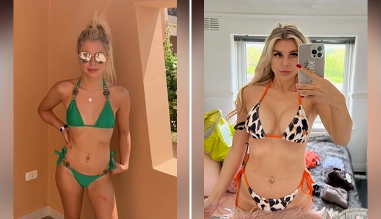 breast augmentation patient results