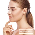 Rhinoplasty – 5 steps to a new nose