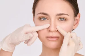 Rhinoplasty for Wide Nose: How Does It Work