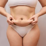 What to do after liposuction