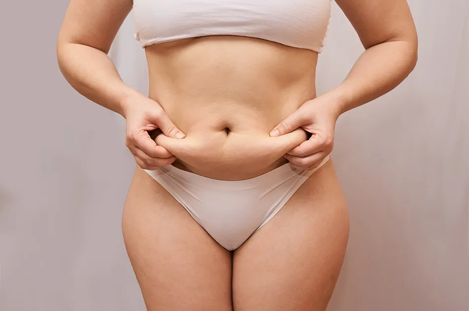 a woman pinches the loose skin on her abdomen