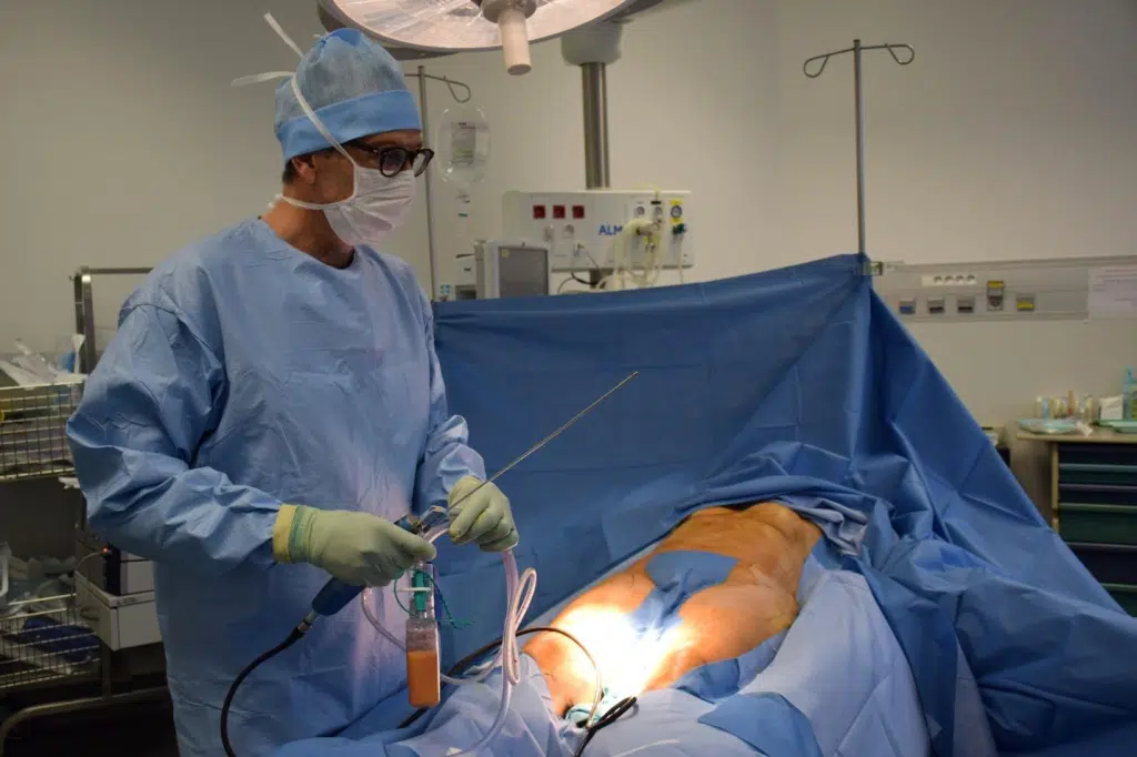 A surgeon doing liposuction