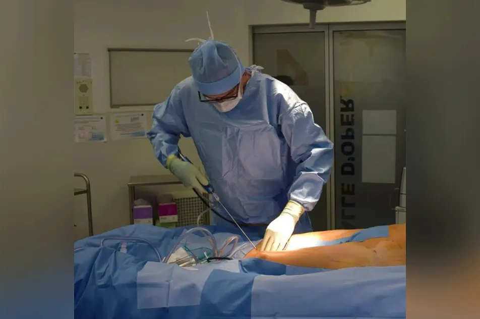 Treatment of lipoedema with liposuction