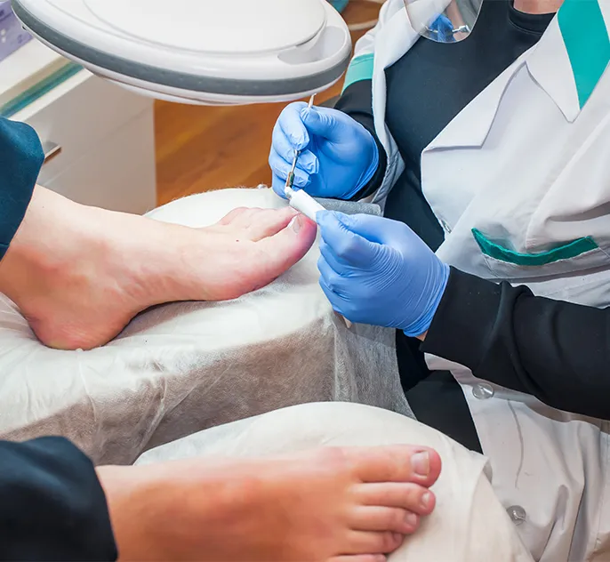 Toenail Removal