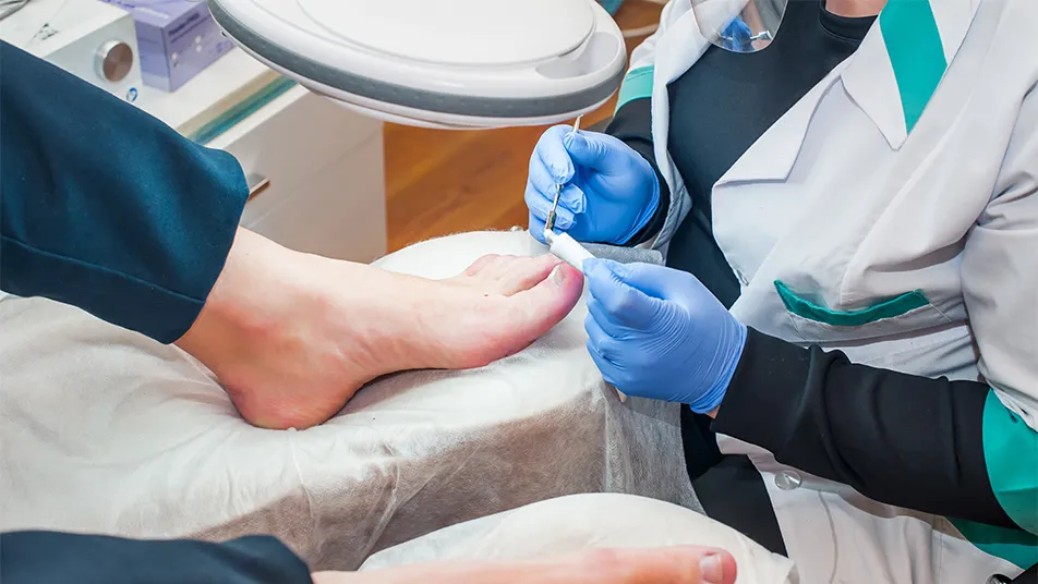 Toenail Removal