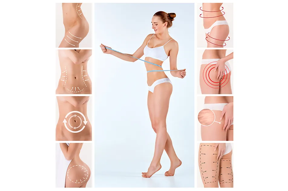 liposuction body areas