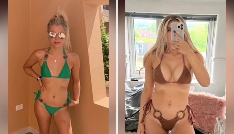 breast augmentation patient
