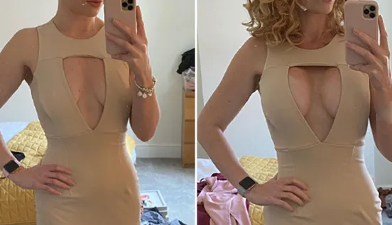 breast augmentation before and after-2