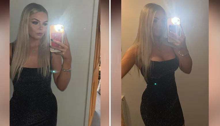 breast augmentation before and after-11