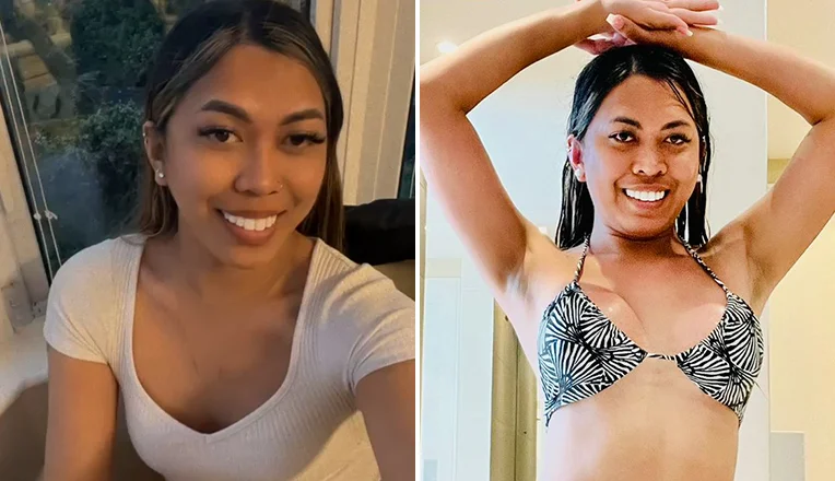 boob job before and after patient-13-v2