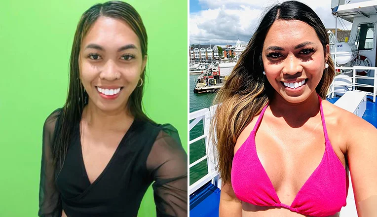boob job before and after patient-13