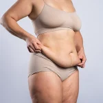 Will loose skin remain after Liposuction?