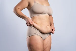 Will loose skin remain after Liposuction?