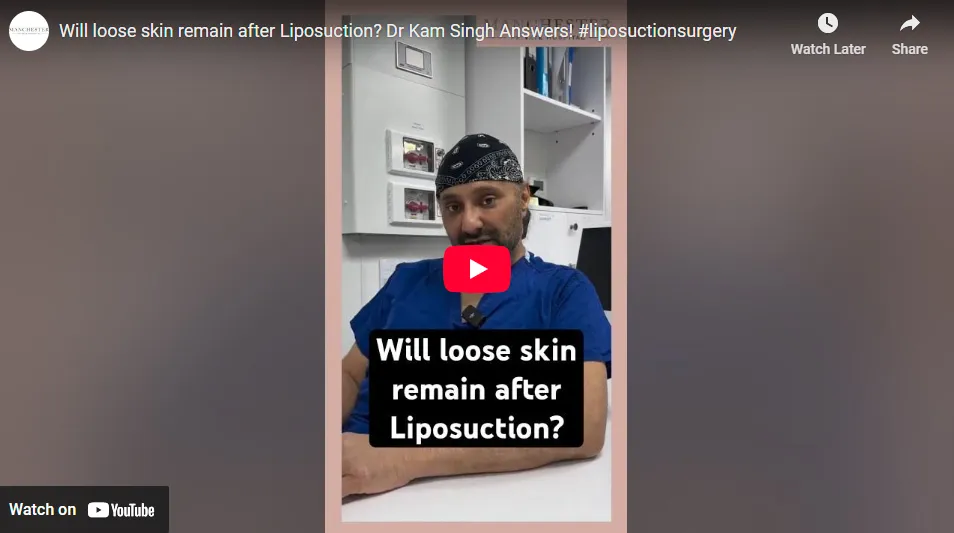 Will My Weight Return After Liposuction? Mr. Kam Singh Explains