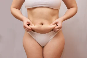 Top Tips for Choosing the Best Tummy Tuck Surgeon in the UK