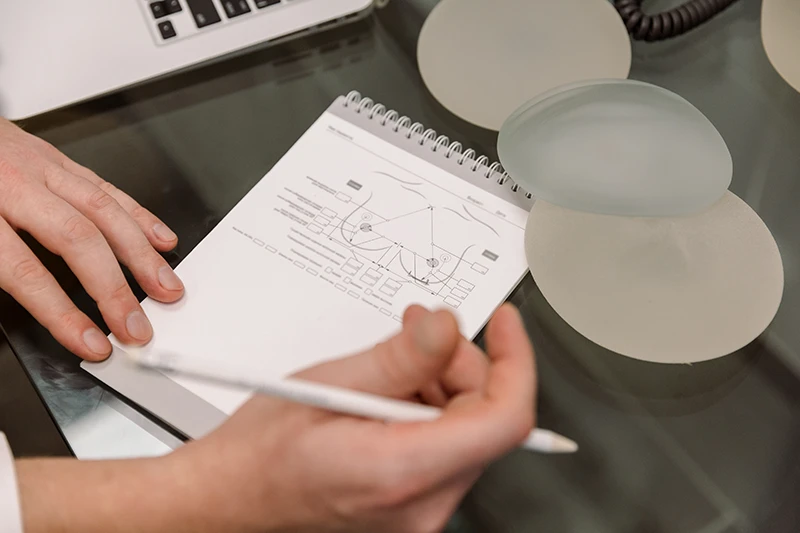 Cosmetic surgeon reviewing breast augmentation surgical diagram with silicone implants on the table.