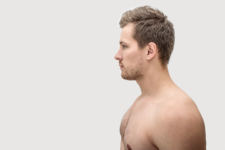 side profile view of a male rhinoplasty patient showing nasal shape