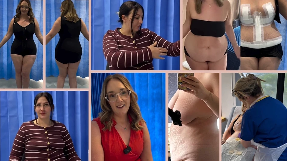 Collage of mummy makeover patients featured in Manchester Private Hospital testimonials