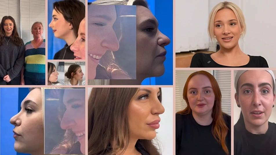 Collage of rhinoplasty patients featured in Manchester Private Hospital testimonials